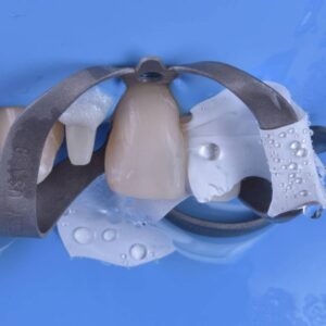 teflon in odontoiatria - teflon bagnato